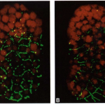 Cell fusions in the developing epithelial of C. elegans
